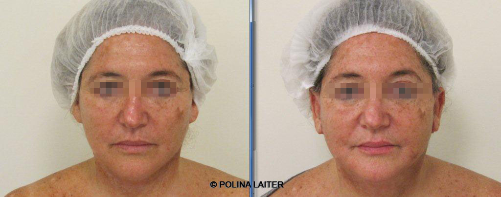 Полина Лайтер - автор методики Reface-Laitlift